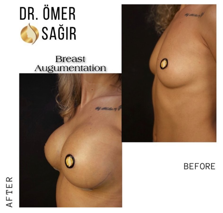 Op. Dr. Ömer Sağır - Op. Dr. Ömer Sağır