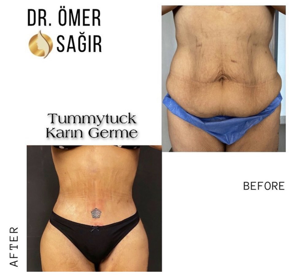 Op. Dr. Ömer Sağır - Op. Dr. Ömer Sağır