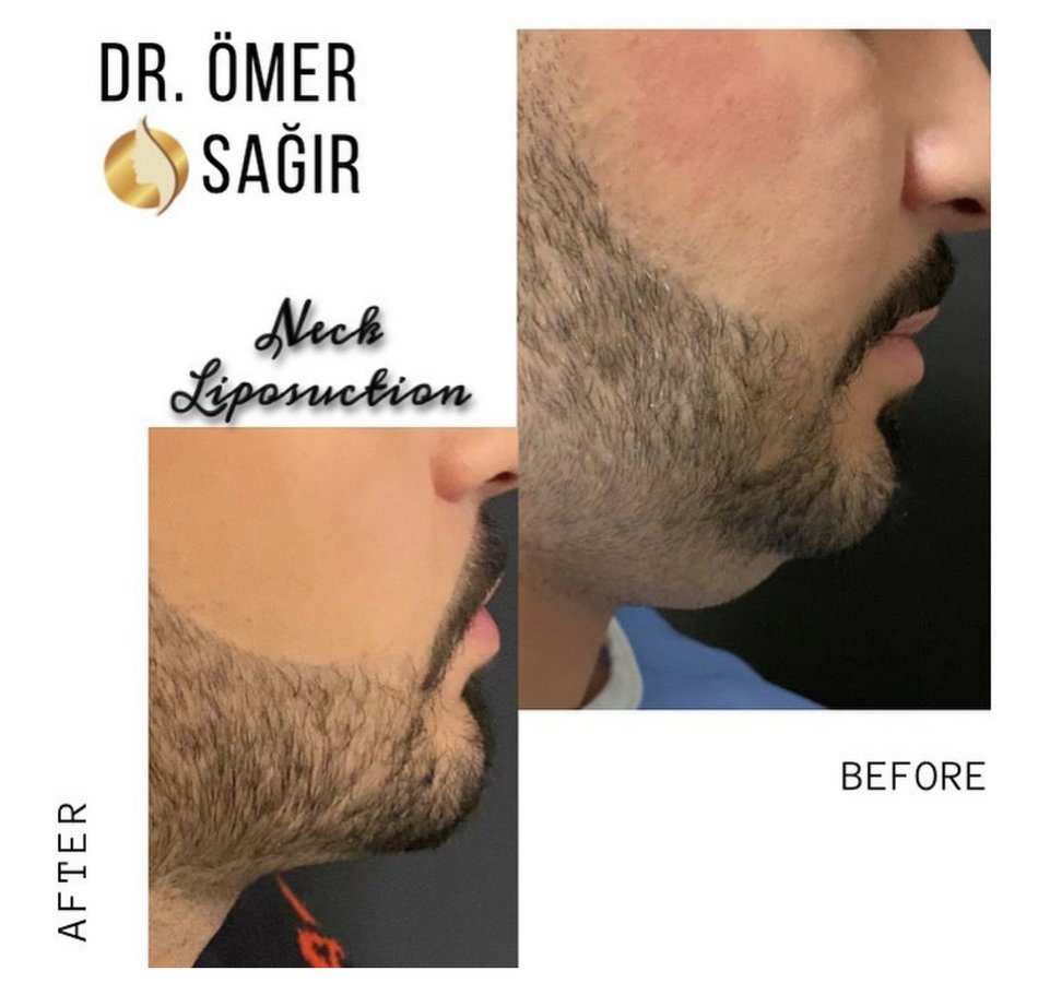 Op. Dr. Ömer Sağır - Op. Dr. Ömer Sağır