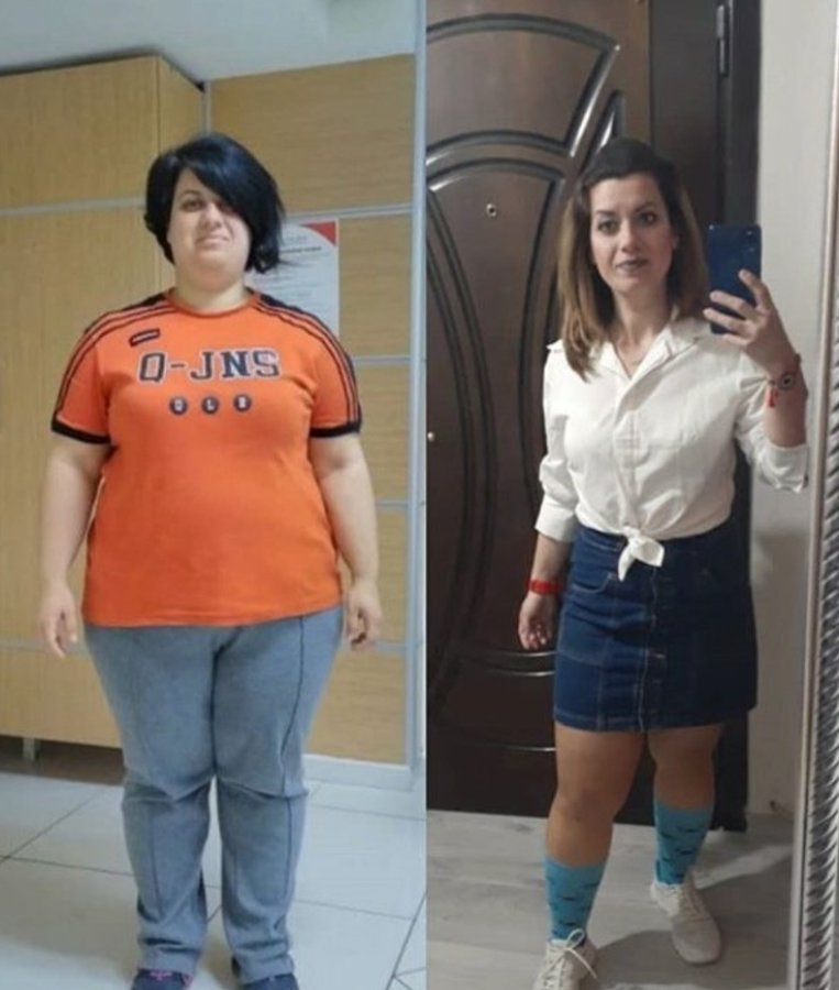 Op. Dr. Ozgun Akgul - Op. Dr. Ozgun Akgul