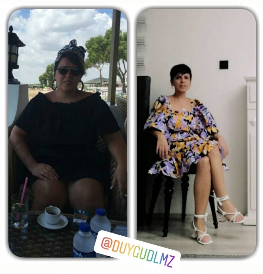 Op. Dr. Ozgun Akgul - Op. Dr. Ozgun Akgul