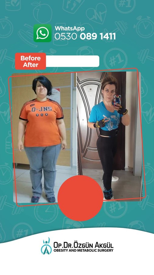 Op. Dr. Ozgun Akgul - Op. Dr. Ozgun Akgul