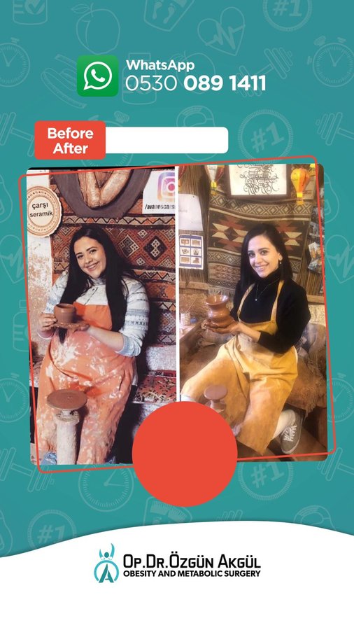 Op. Dr. Ozgun Akgul - Op. Dr. Ozgun Akgul