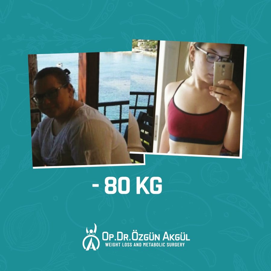 Op. Dr. Ozgun Akgul - Op. Dr. Ozgun Akgul