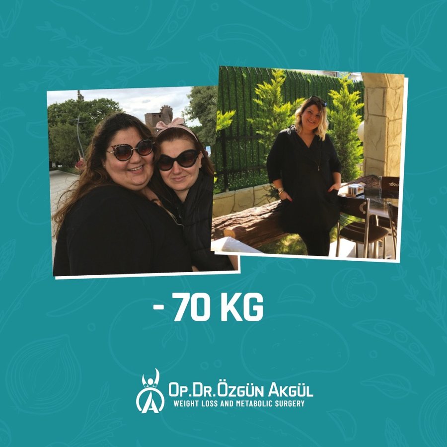 Op. Dr. Ozgun Akgul - Op. Dr. Ozgun Akgul