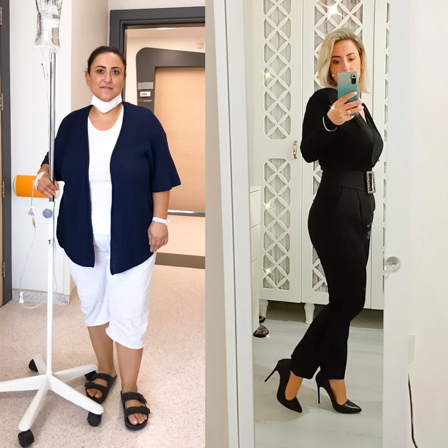 OP. الدكتور توفان جراحة السمنة عيادة - OP. DR. TUFAN ERGENC OBESITY SURGERY CLINIC