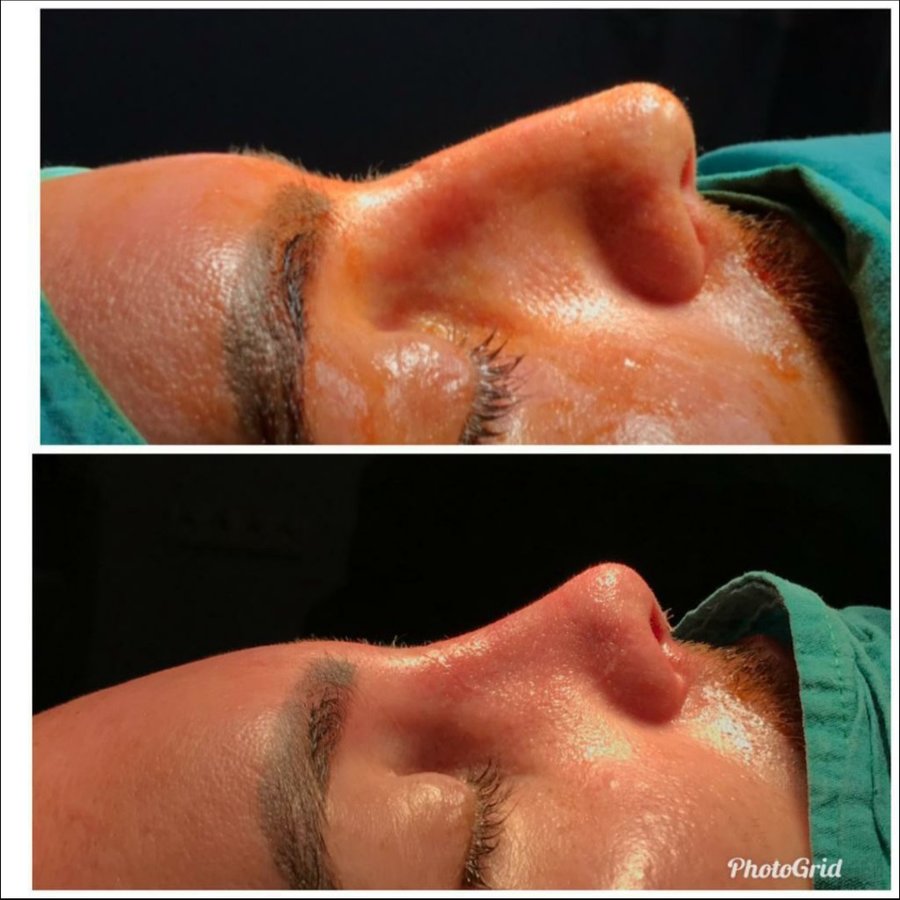 Op Dr Yilmaz Geyik - Op Dr Yilmaz Geyik