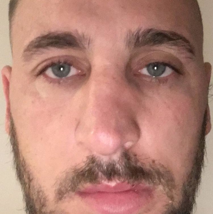 Op Dr Yilmaz Geyik - Op Dr Yilmaz Geyik