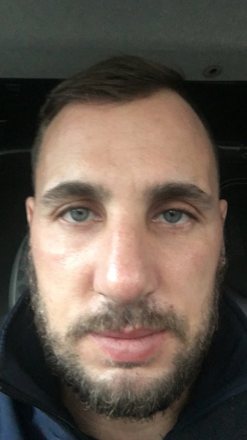 Op Dr Yilmaz Geyik - Op Dr Yilmaz Geyik