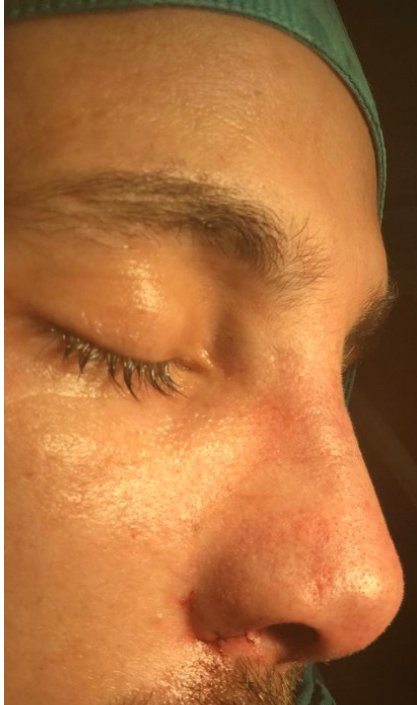 Op Dr Yilmaz Geyik - Op Dr Yilmaz Geyik