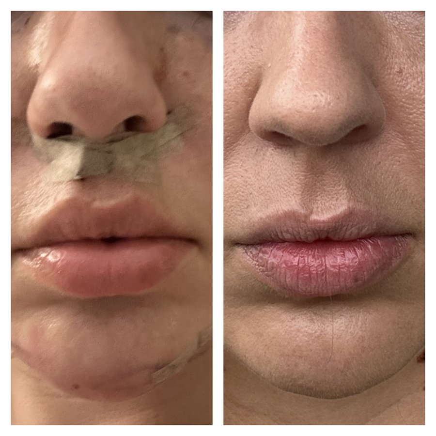 Op Dr Yilmaz Geyik - Op Dr Yilmaz Geyik