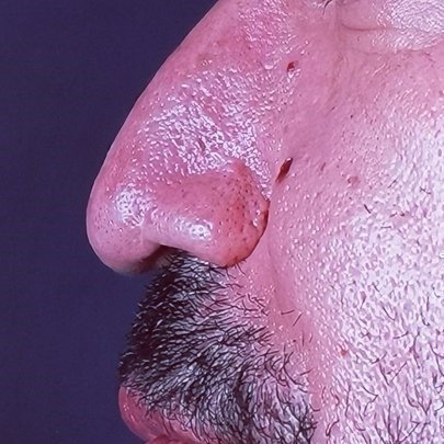 Op Dr Yilmaz Geyik - Op Dr Yilmaz Geyik