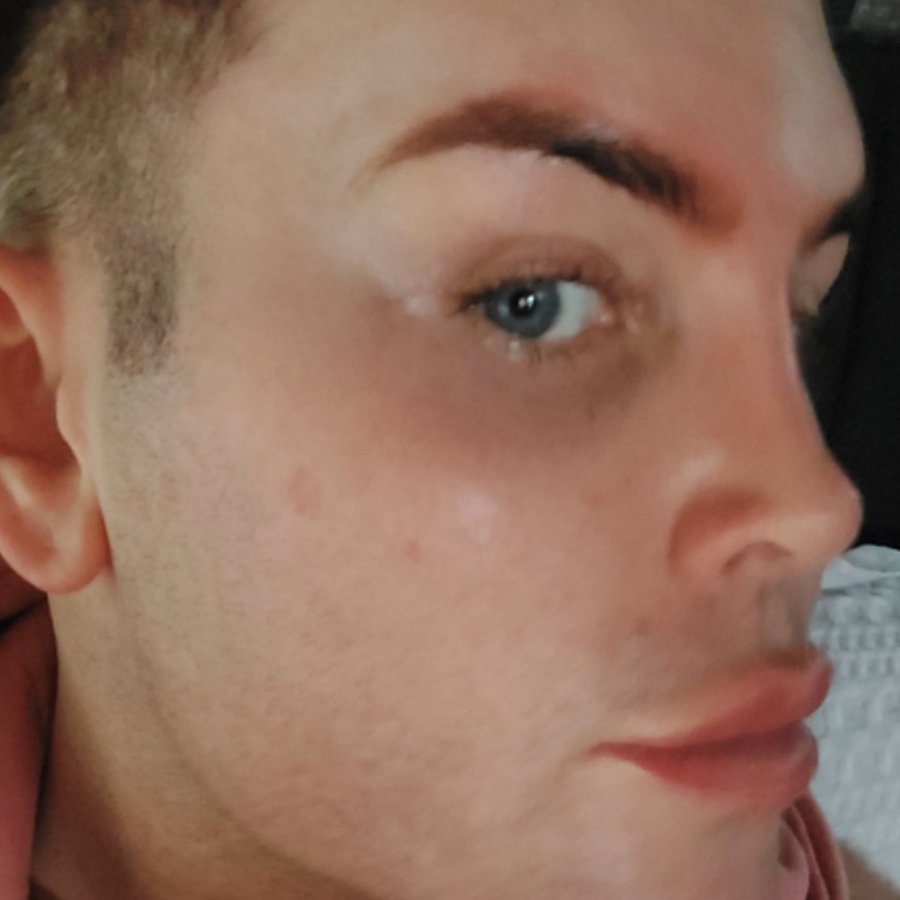 Op Dr Yilmaz Geyik - Op Dr Yilmaz Geyik