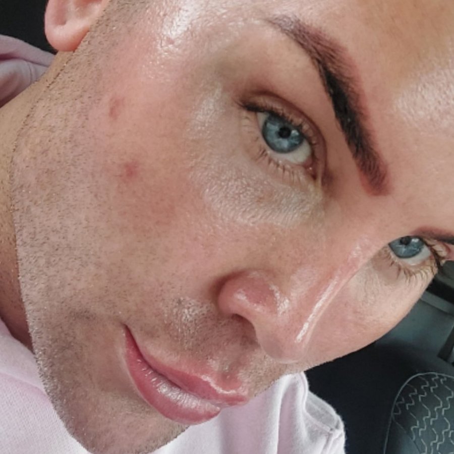 Op Dr Yilmaz Geyik - Op Dr Yilmaz Geyik