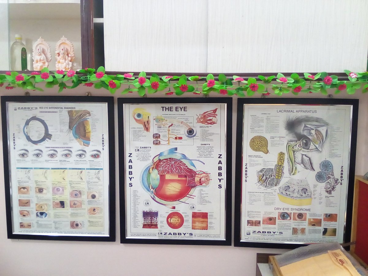 Opticulus - Opticulus