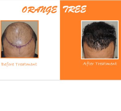 Orange tree aesthetic and hair restoration centre - Orange tree aesthetic and hair restoration centre
