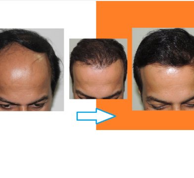 Orange tree aesthetic and hair restoration centre - Orange tree aesthetic and hair restoration centre
