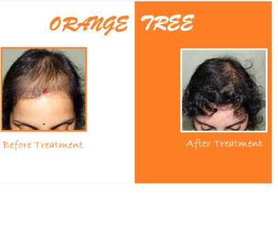 Orange tree aesthetic and hair restoration centre - Orange tree aesthetic and hair restoration centre