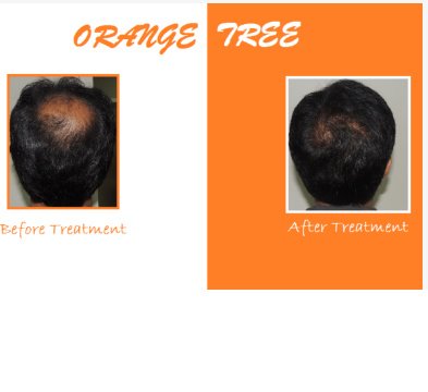 Orange tree aesthetic and hair restoration centre - Orange tree aesthetic and hair restoration centre