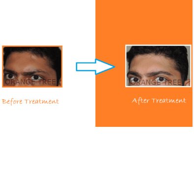 Orange tree aesthetic and hair restoration centre - Orange tree aesthetic and hair restoration centre