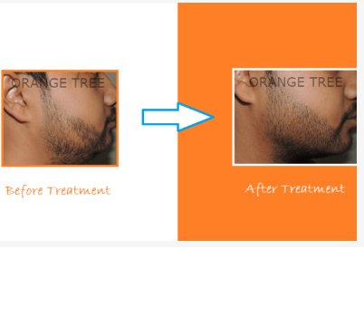Orange tree aesthetic and hair restoration centre - Orange tree aesthetic and hair restoration centre