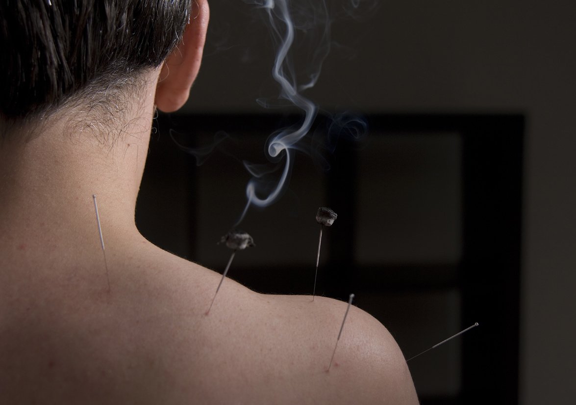 Oriental Healing Arts Macclesfield Clinic - Oriental Healing Arts Macclesfield Clinic