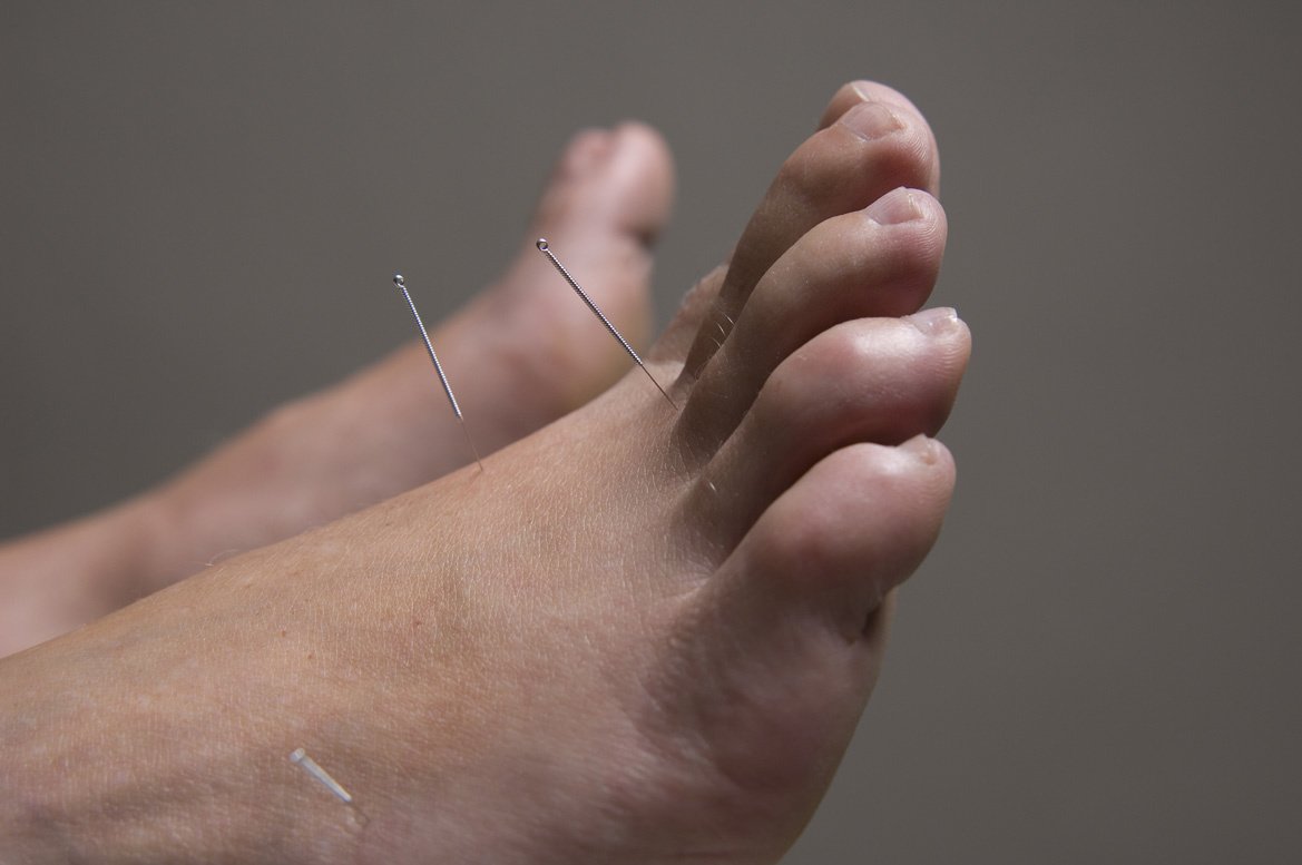 Oriental Healing Arts Macclesfield Clinic - Oriental Healing Arts Macclesfield Clinic