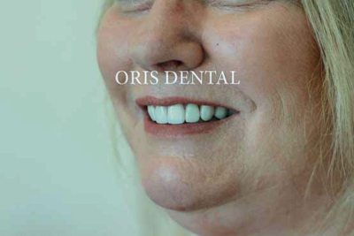 Oris Dental  - Dr. Adarsh 