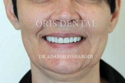 Oris Dental  - Dr. Adarsh 