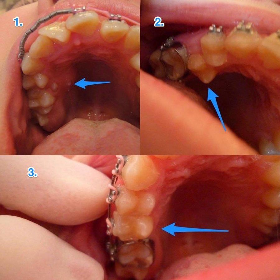 Ortho Keep Smiling - Bearwood Dental Care - Ortho Keep Smiling - Bearwood Dental Care