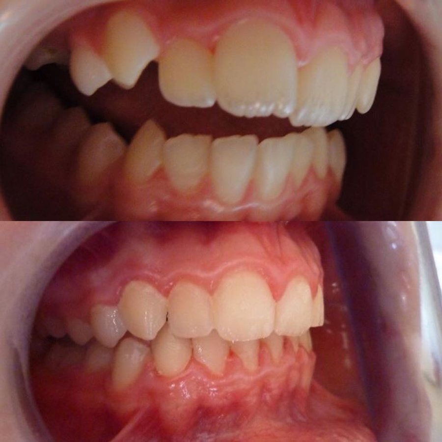 Ortho Keep Smiling - Bearwood Dental Care - Ortho Keep Smiling - Bearwood Dental Care