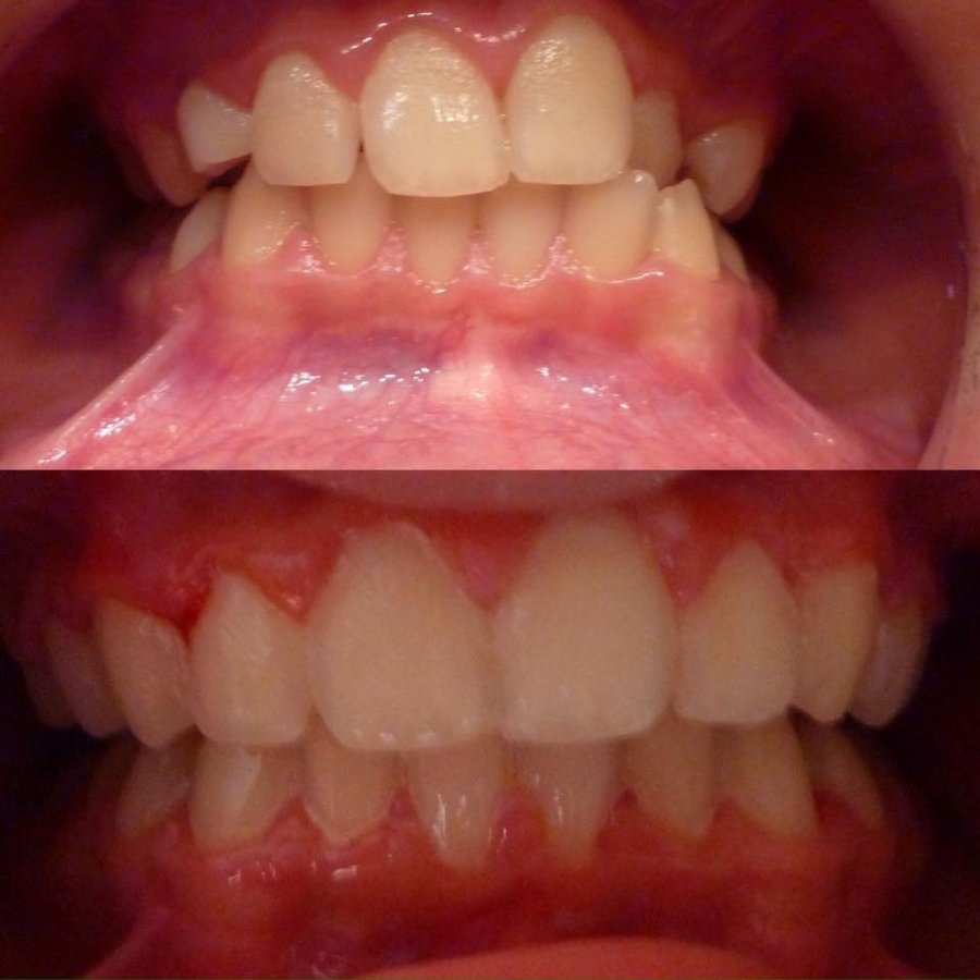 Ortho Keep Smiling - Bearwood Dental Care - Ortho Keep Smiling - Bearwood Dental Care