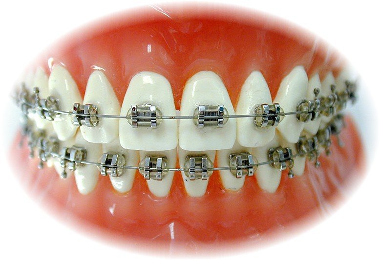 ORTHODONTIC MASTERS & St. Joseph's Hospital - ORTHODONTIC MASTERS & St. Joseph's Hospital