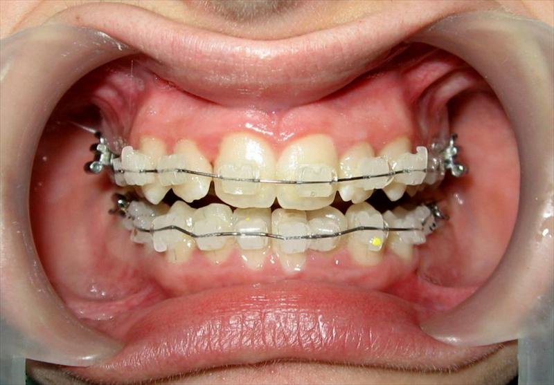 ORTHODONTIC MASTERS & St. Joseph's Hospital - ORTHODONTIC MASTERS & St. Joseph's Hospital