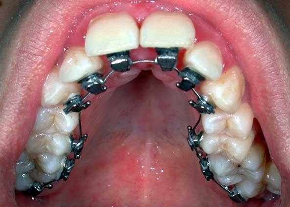 ORTHODONTIC MASTERS & St. Joseph's Hospital - ORTHODONTIC MASTERS & St. Joseph's Hospital