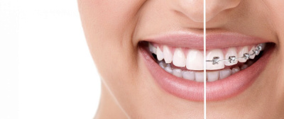 Orthodontist In Dubai | Dr. Firas Hamzeh - Orthodontist In Dubai | Dr. Firas Hamzeh