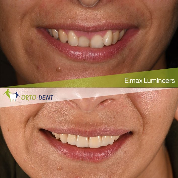 Ortodent Dental Clinic - Ortodent Dental Clinic