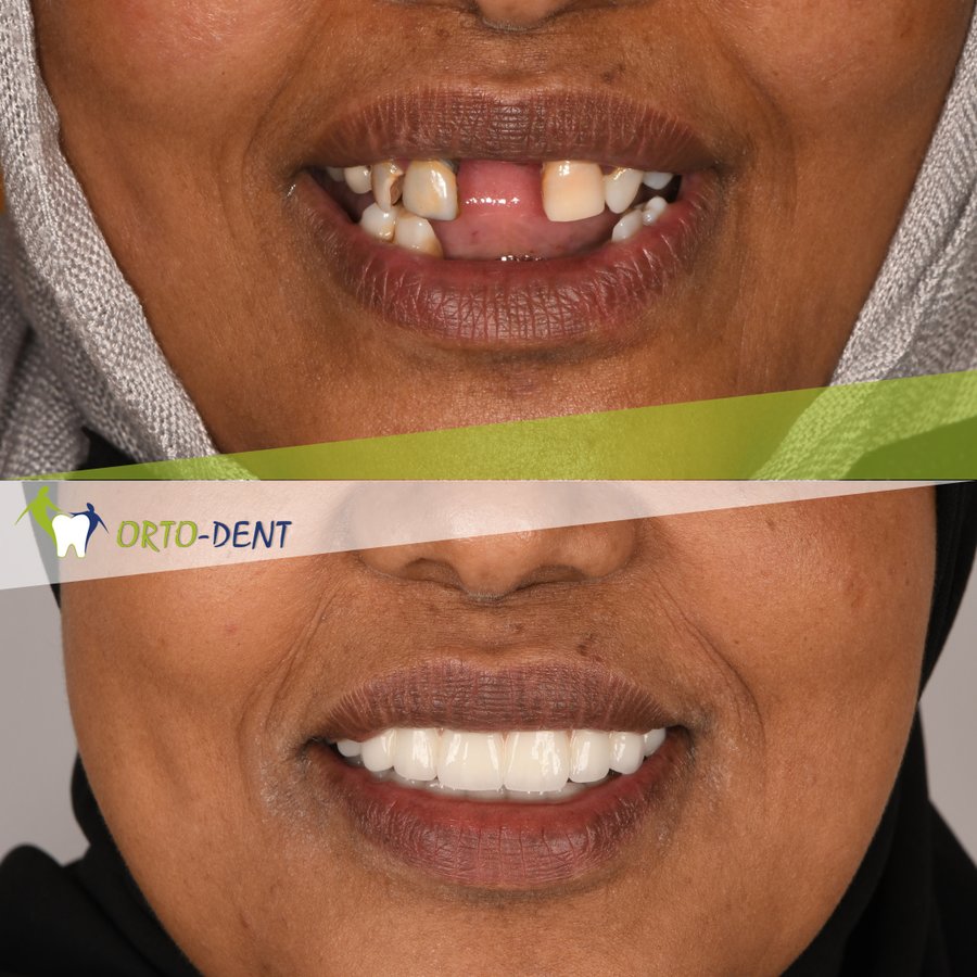 Ortodent Dental Clinic - Ortodent Dental Clinic