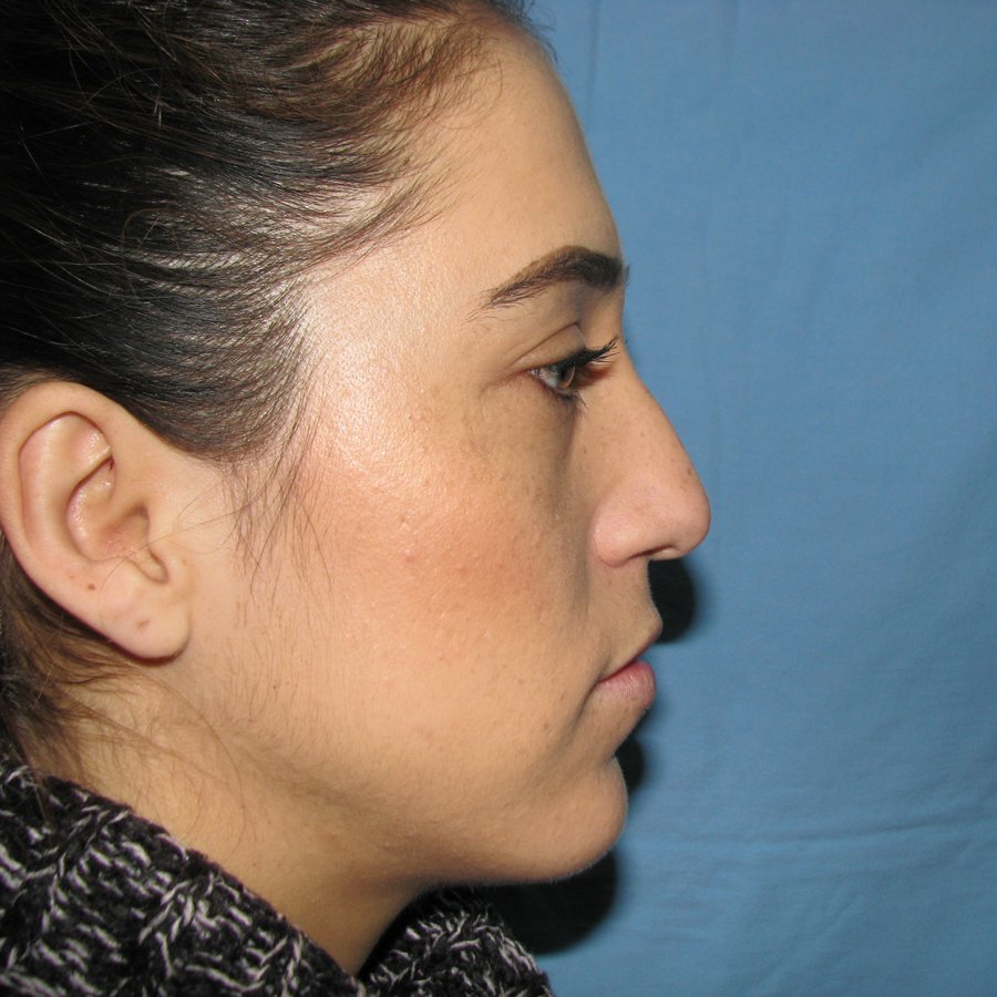 Otorrino Tijuana Dr. Lumban - Otorrino Tijuana Dr. Lumban