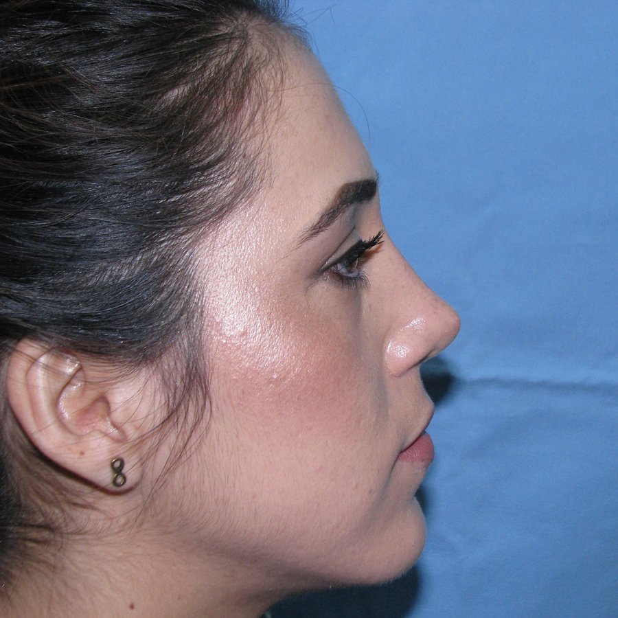 Otorrino Tijuana Dr. Lumban - Otorrino Tijuana Dr. Lumban