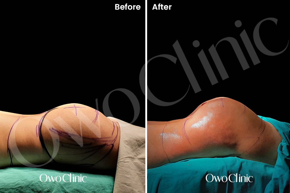 Owo Clinic - Owo Clinic