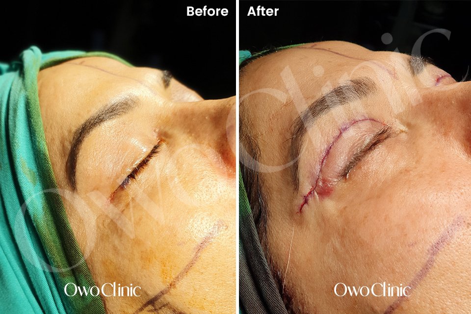 Owo Clinic - Owo Clinic