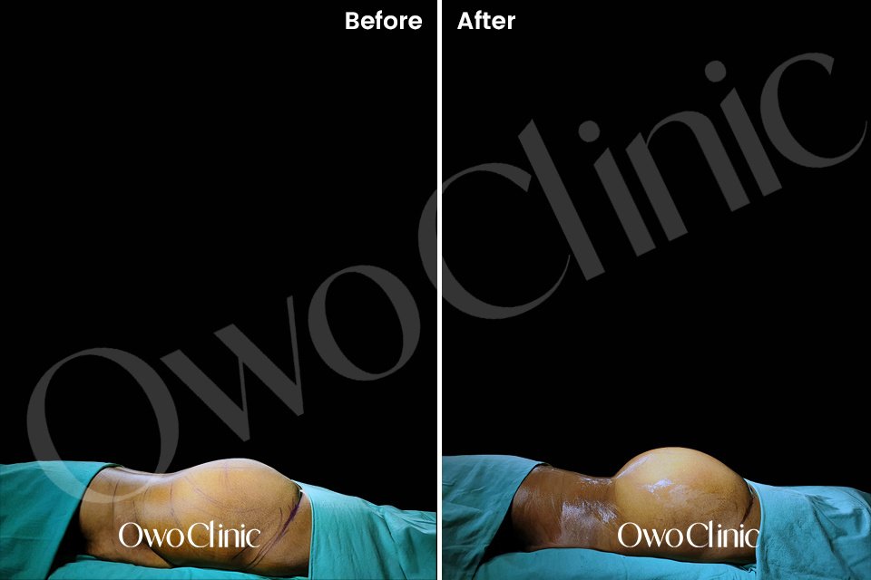 Owo Clinic - Owo Clinic