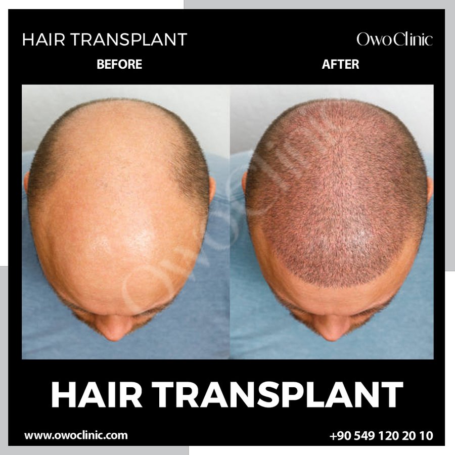 Owo Clinic - Owo Clinic