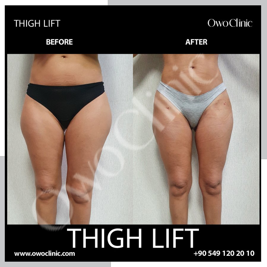 Owo Clinic - Owo Clinic