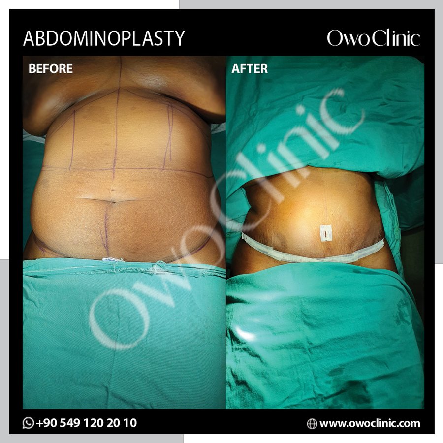 Owo Clinic - Owo Clinic