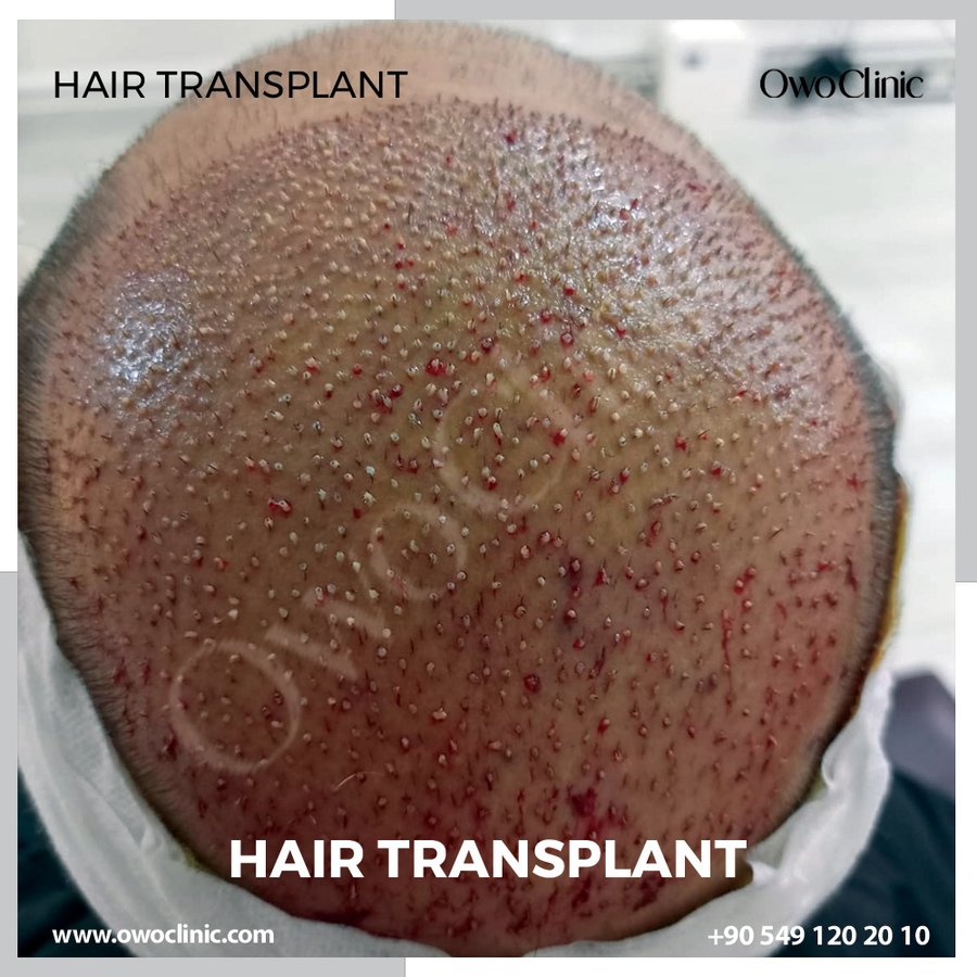 Owo Clinic - Owo Clinic