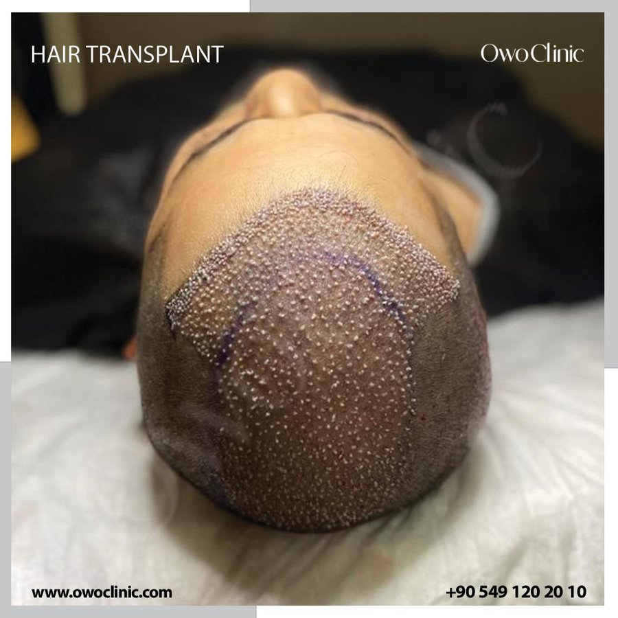 Owo Clinic - Owo Clinic