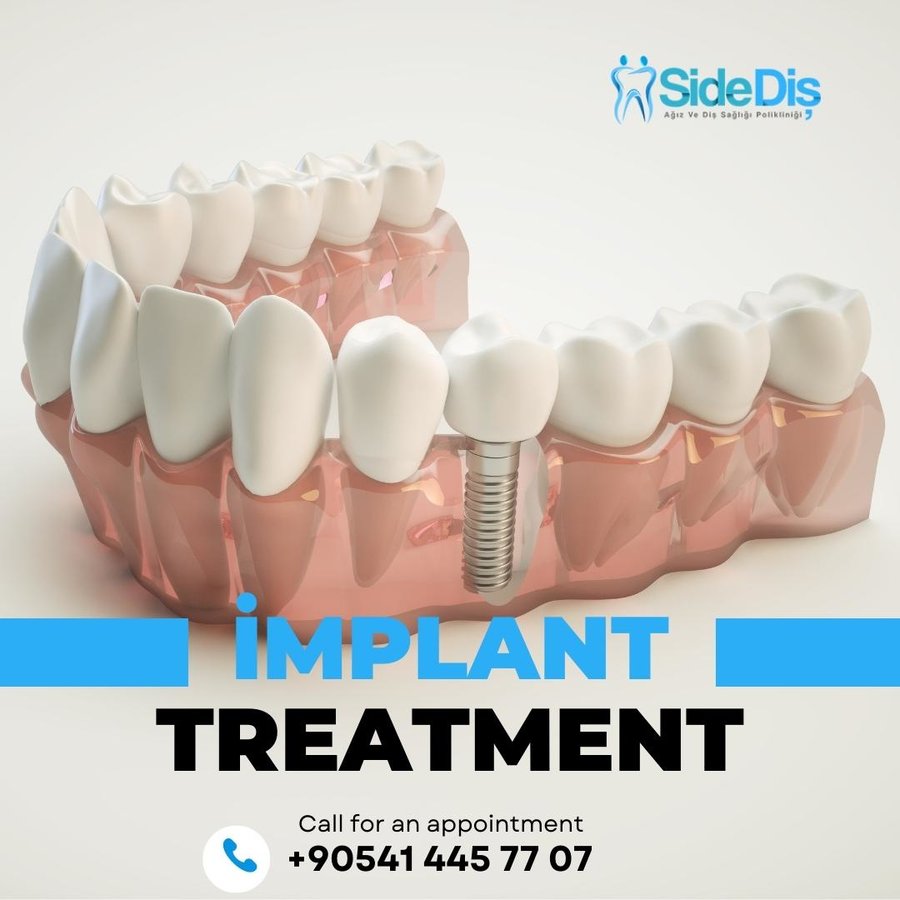 Özel Side Ağız ve Diş Sağlığı Polikliniği - Özel Side Ağız ve Diş Sağlığı Polikliniği