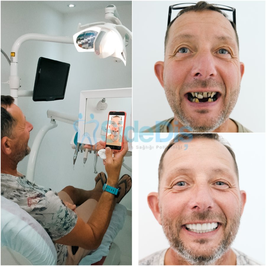 Özel Side Ağız ve Diş Sağlığı Polikliniği - Özel Side Ağız ve Diş Sağlığı Polikliniği